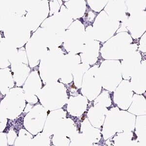 Merck Anti-PIGF antibody produced in rabbit