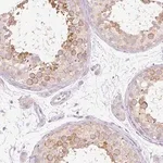 Merck Anti-PDXDC1 antibody produced in rabbit