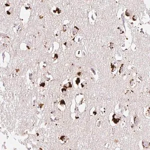 Merck Anti-CLEC3A antibody produced in rabbit