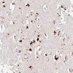 Merck Anti-CLEC3A antibody produced in rabbit