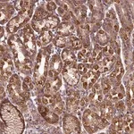 Merck Anti-ZNF513 antibody produced in rabbit