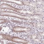 Merck Anti-FAM65C antibody produced in rabbit