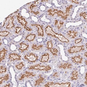 Merck Anti-RADIL antibody produced in rabbit