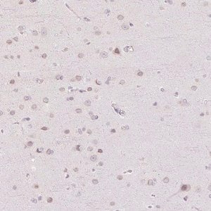 Merck Anti-TBX15 antibody produced in rabbit
