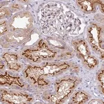 Merck Anti-PIK3R5 antibody produced in rabbit