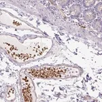 Merck Anti-USHBP1 antibody produced in rabbit