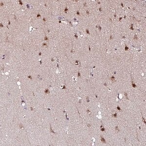 Merck Anti-KLF16 antibody produced in rabbit