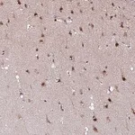 Merck Anti-KLF16 antibody produced in rabbit