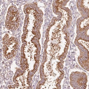 Merck Anti-SCNM1 antibody produced in rabbit