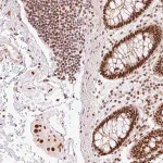 Merck Anti-ZBTB44 antibody produced in rabbit