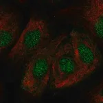 Merck Anti-ZNF319 antibody produced in rabbit