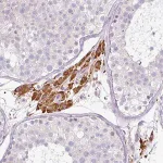 Merck Anti-FGF17 antibody produced in rabbit
