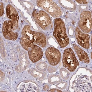 Merck Anti-CTDSP2 antibody produced in rabbit