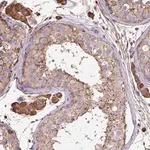 Merck Anti-MAGEB5 antibody produced in rabbit