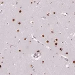 Merck Anti-C2orf82 antibody produced in rabbit