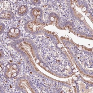 Merck Anti-CHST11 antibody produced in rabbit