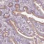 Merck Anti-CHST11 antibody produced in rabbit