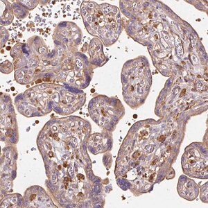 Merck Anti-TBC1D2B antibody produced in rabbit