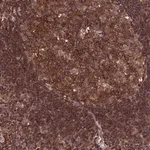 Merck Anti-PKD2L2 antibody produced in rabbit