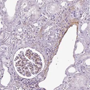 Merck Anti-ATP10A antibody produced in rabbit