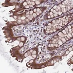 Merck Anti-EFCAB8 antibody produced in rabbit