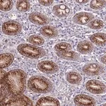 Merck Anti-RGS11 antibody produced in rabbit