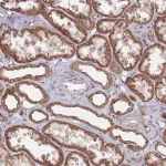 Merck Anti-CCDC106 antibody produced in rabbit