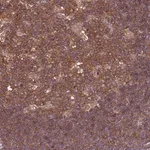 Merck Anti-ATXN2L antibody produced in rabbit