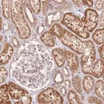 Merck Anti-OSBP antibody produced in rabbit