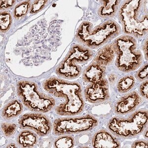 Merck Anti-PKD2L2 antibody produced in rabbit