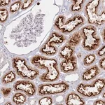 Merck Anti-PKD2L2 antibody produced in rabbit