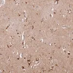 Merck Anti-RIMBP2 antibody produced in rabbit