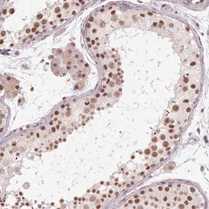 Merck Anti-CYHR1 antibody produced in rabbit