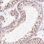 Merck Anti-CYHR1 antibody produced in rabbit