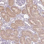 Merck Anti-CTU1 antibody produced in rabbit