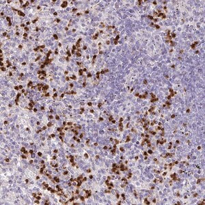 Merck Anti-RCAN2 antibody produced in rabbit