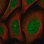 Merck Anti-SCN4A antibody produced in rabbit