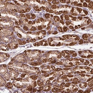 Merck Anti-TM2D3 antibody produced in rabbit