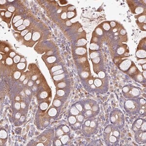 Merck Anti-ZNF266 antibody produced in rabbit