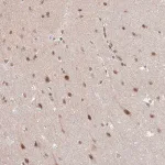 Merck Anti-NEIL1 antibody produced in rabbit