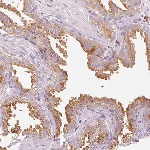 Merck Anti-TMC8 antibody produced in rabbit