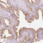 Merck Anti-TMC8 antibody produced in rabbit