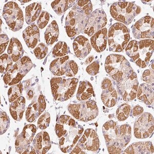 Merck Anti-PNPLA5 antibody produced in rabbit