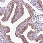 Merck Anti-ICE1 antibody produced in rabbit