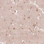 Merck Anti-DHX35 antibody produced in rabbit