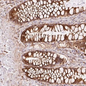 Merck Anti-RAB30 antibody produced in rabbit