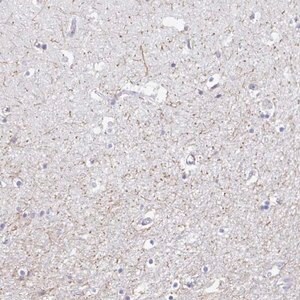 Merck Anti-SERTM1 antibody produced in rabbit