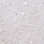 Merck Anti-SERTM1 antibody produced in rabbit