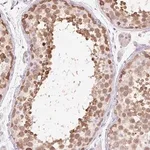 Merck Anti-ZNF121 antibody produced in rabbit
