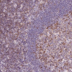 Merck Anti-TIGD2 antibody produced in rabbit